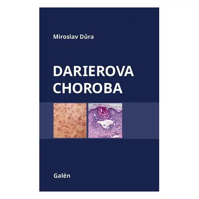 Darierova choroba - Miroslav Důra