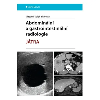 Abdominální a gastrointestinální radiologie - Vlastimil Válek