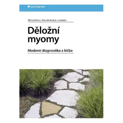 Děložní myomy - Zdeněk Holub