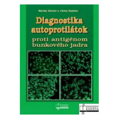 Diagnostika autoprotilátok proti antigénom bunkového jadra - Marián Benčat