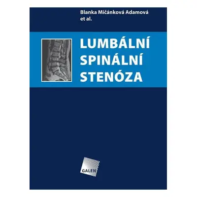 Lumbální spinální stenóza - Blanka Mičánková Adamová