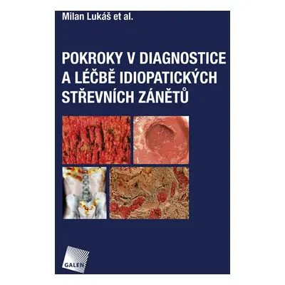 Pokroky v diagnostice a léčbě idiopatických střevních zánětů - Milan Lukáš