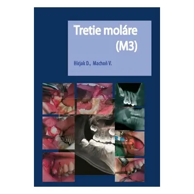 Tretie moláre (M3) - Vladimír Machoň