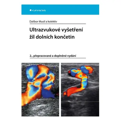 Ultrazvukové vyšetření žil dolních končetin - kolektiv a