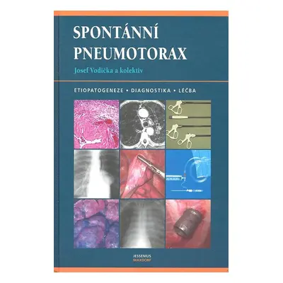 Spontánní pneumotorax - Josef Vodička