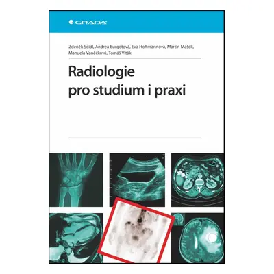 Radiologie pro studium i praxi - Eva Hoffmannová