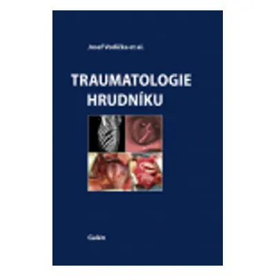 Traumatologie hrudníku - Josef Vodička