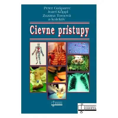 Cievne prístupy - Kolektív autorov