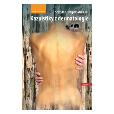 Kazuistiky z dermatologie - Spyridon Gkalpakiotis