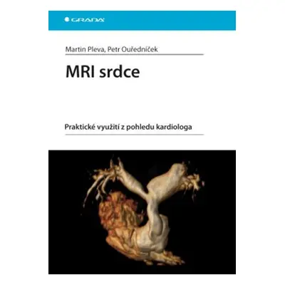 MRI srdce - Petr Ouředníček