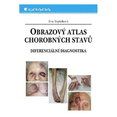 Obrazový atlas chorobných stavů - Eva Topinková