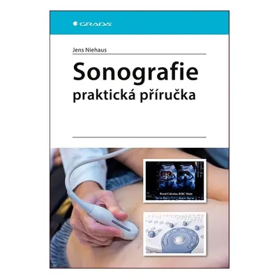 Sonografie Praktická příručka - Jens Niehaus