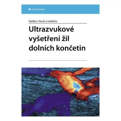 Ultrazvukové vyšetření žil dolních končetin - kolektiv a