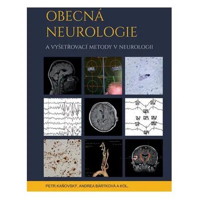 Obecná neurologie a vyšetřovací metody v neurologii - Andrea Bártková