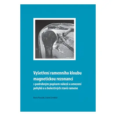 Vyšetření ramenního kloubu magnetickou rezonancí s podrobným popisem nálezů u omezení pohybů u b