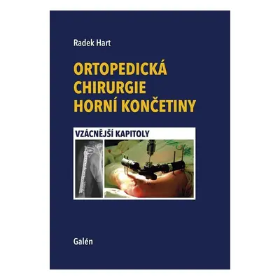 Ortopedická chirurgie horní končetiny - Radek Hart