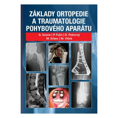 Základy ortopedie a traumatologie pohybového aparátu - P. Fulín