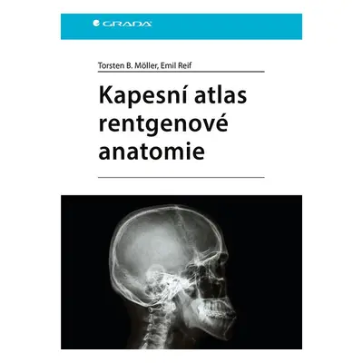 Kapesní atlas rentgenové anatomie - Torsten B. Möller