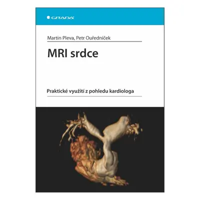 MRI srdce - Petr Ouředníček