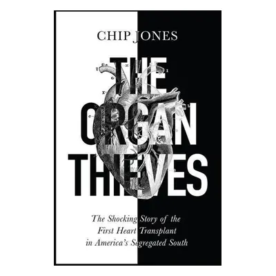 The Organ Thieves - Chip Jones