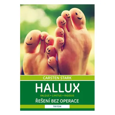 Hallux Řešení bez operace - Carsten Stark