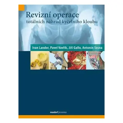 Revizní operace totálních náhrad kyčelního kloubu - Jiří Gallo