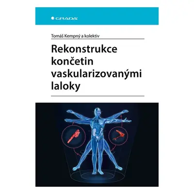 Rekonstrukce končetin vaskularizovanými laloky - Tomáš Kempný