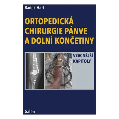 Ortopedická chirurgie pánve a dolní končetiny - Radek Hart