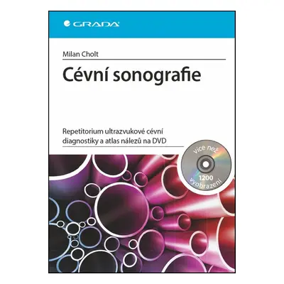 Cévní sonografie - Milan Cholt