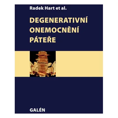 Degenerativní onemocnění páteře - Radek Hart