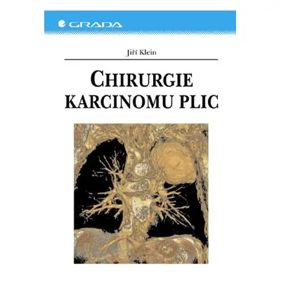 Chirurgie karcinomu plic - Jiří Klein