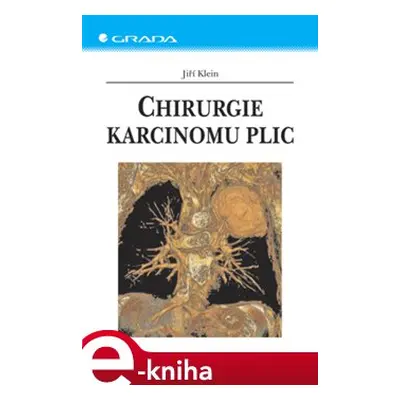 Chirurgie karcinomu plic - Jiří Klein