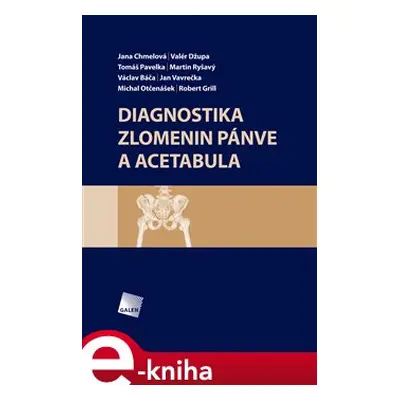 Diagnostika zlomenin pánve a acetabula - Martin Ryšavý, Jana Chmelová, Valér Džupa, Tomáš Pavelk