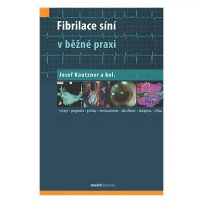 Fibrilace síní v běžné praxi - kolektiv, Josef Kautzner