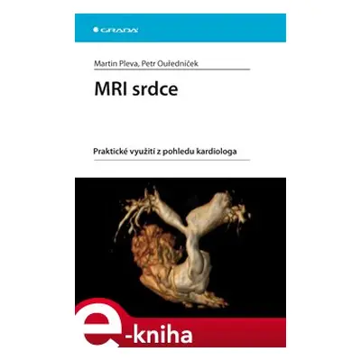 MRI srdce - Martin Pleva, Petr Ouředníček