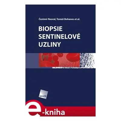 Biopsie sentinelové uzliny - Čestmír Neoral, Tomáš Bohanec