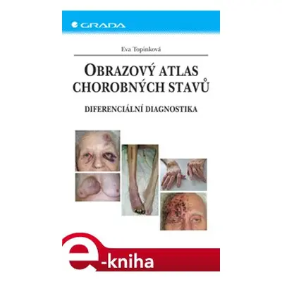 Obrazový atlas chorobných stavů - Eva Topinková