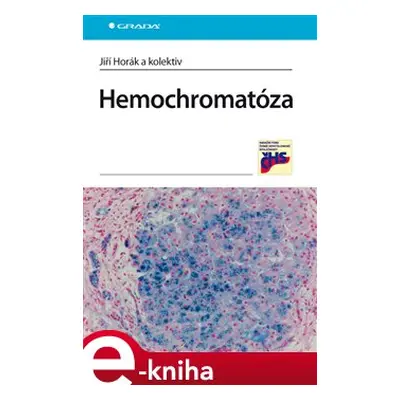 Hemochromatóza - Jiří Horák