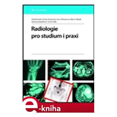 Radiologie pro studium i praxi - Zdeněk Seidl, Andrea Burgetová, Eva Hoffmannová, Martin Mašek, 