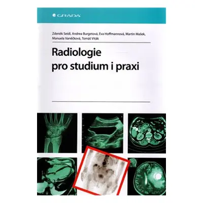 Radiologie pro studium i praxi - Zdeněk Seidl, Andrea Burgetová, Eva Hoffmannová, Martin Mašek, 