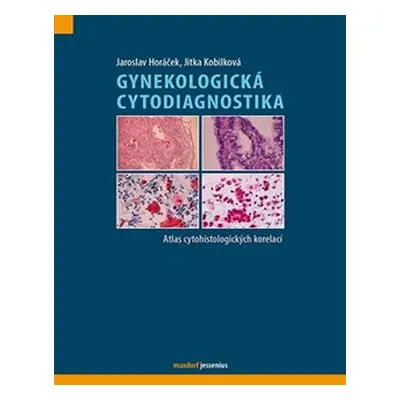 Gynekologická cytodiagnostika - Jitka Kobilková, Jaroslav Horáček