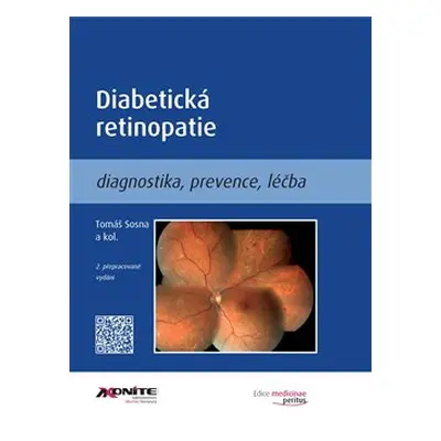 Diabetická retinopatie - Tomáš Sosna, kol.