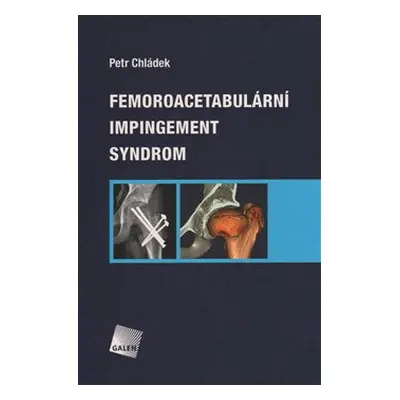 Femoroacetabulární impingement syndrom - Petr Chládek