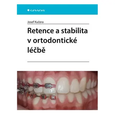 Retence a stabilita v ortodontické léčbě - Josef Kučera