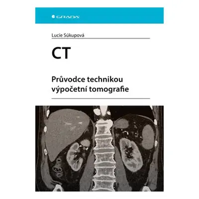 CT - Průvodce technikou výpočetní tomografie - Lucie Súkupová