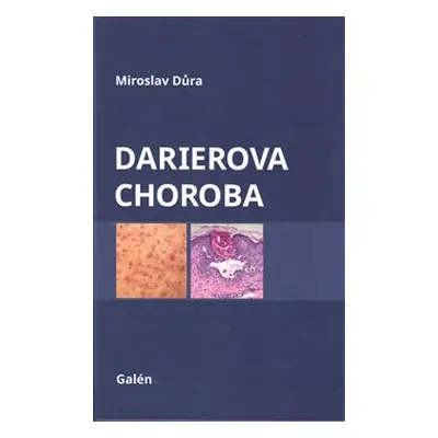 Darierova choroba - Miroslav Důra