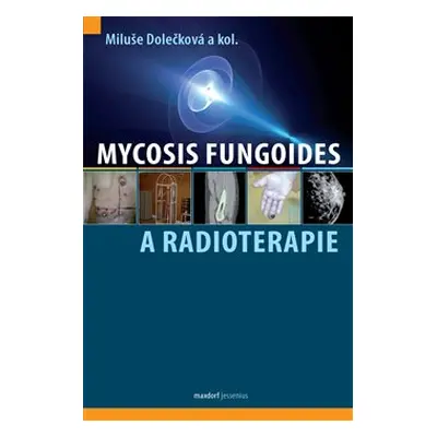 Mycosis fungoides a radioterapie - Miluše Dolečková, kol.