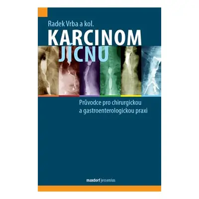 Karcinom jícnu - Radek Vrba, kol.