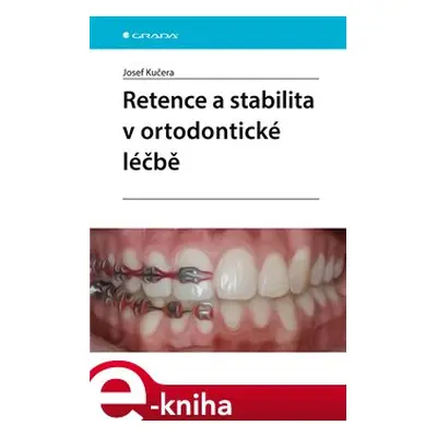 Retence a stabilita v ortodontické léčbě - Josef Kučera