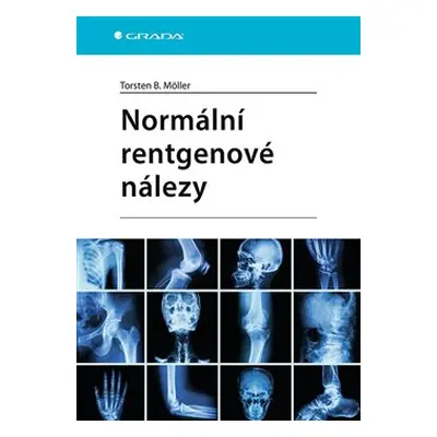 Normální rentgenové nálezy - Torsten B. Möller